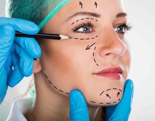 a pretty woman`s face marked by doctor for facelift procedure