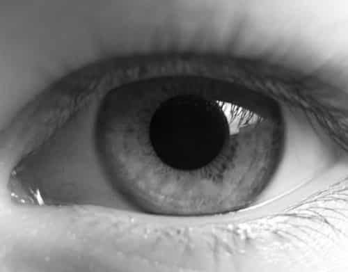 a big eye Tear Trough Treatments needed