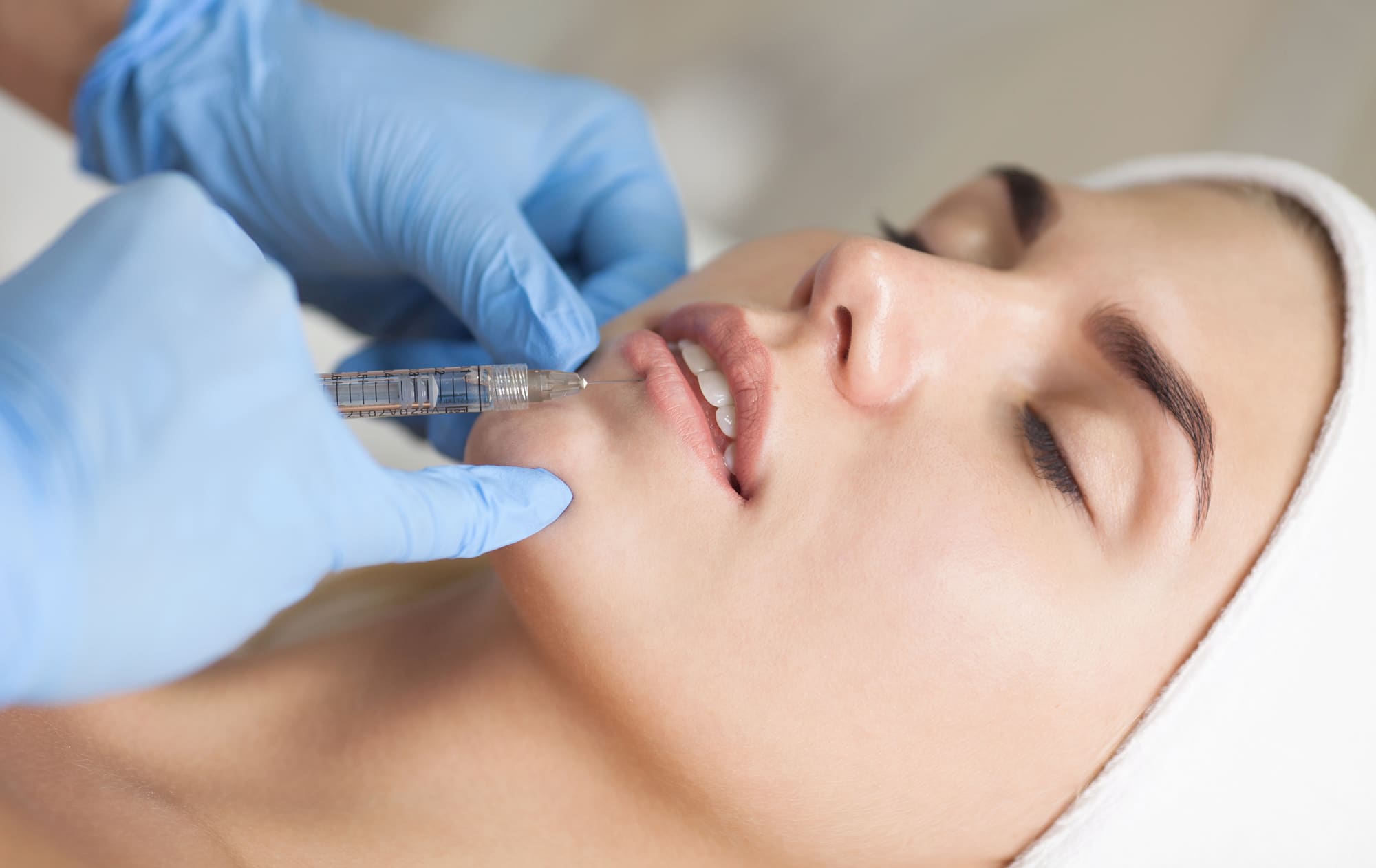 Lip Filler Techniques: What You Need to Know | Medical Spa RX