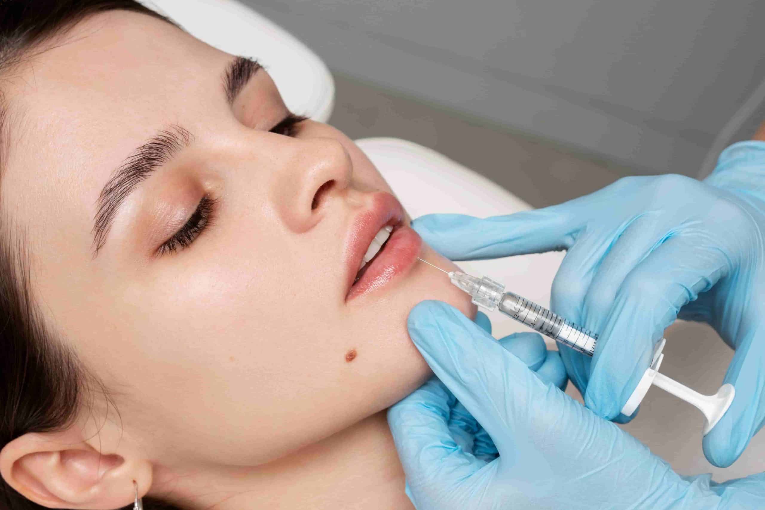woman in a lip filler treatment