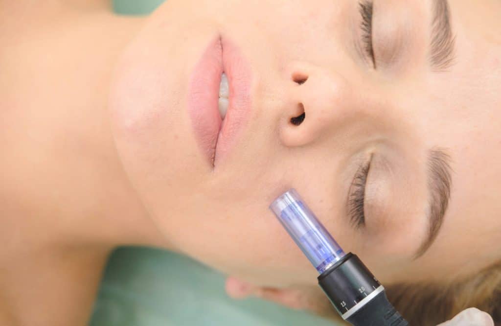 woman getting a facial mesotherapy treatment