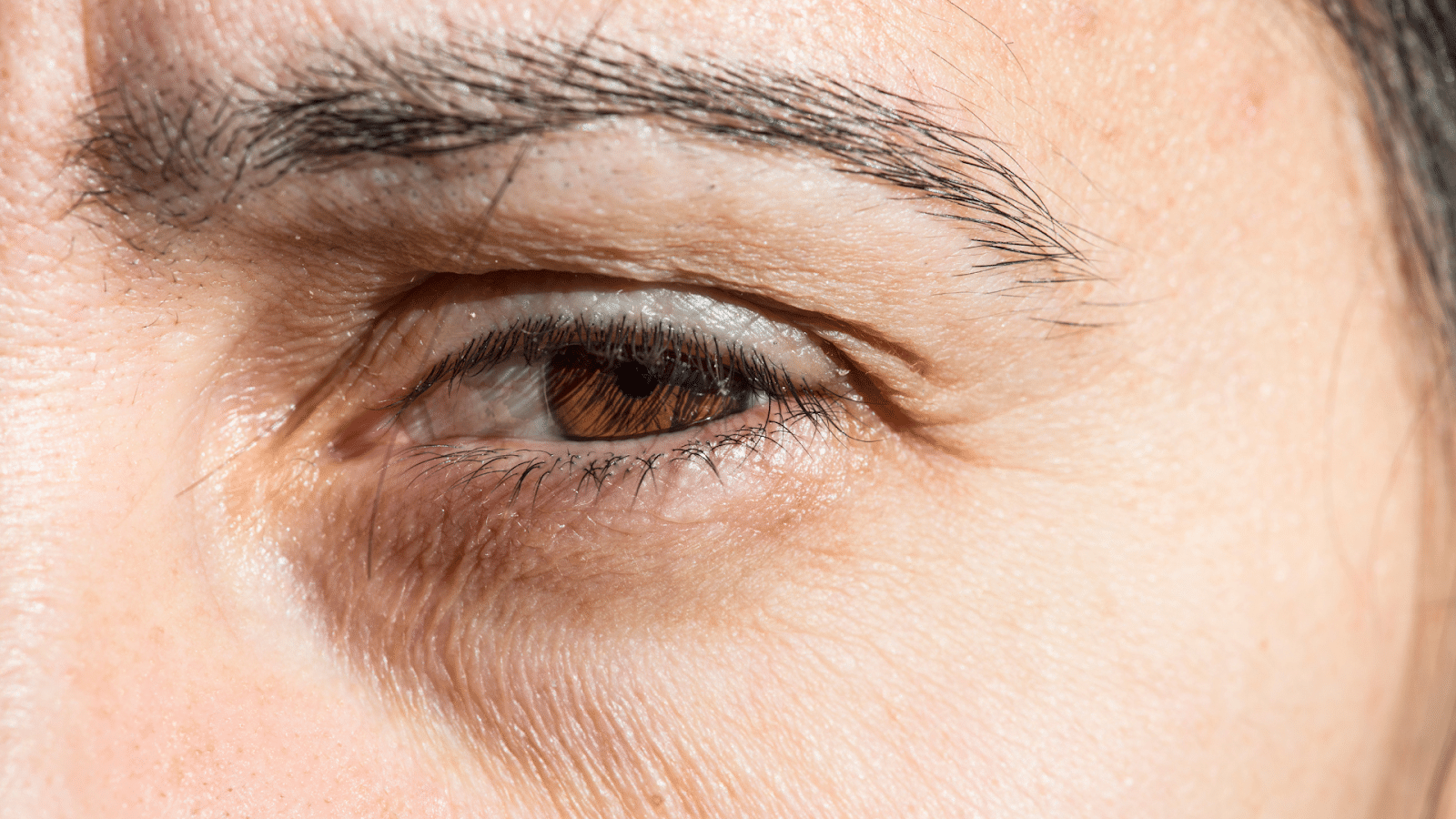 Close-up of an individual experiencing under eye concerns due to age.