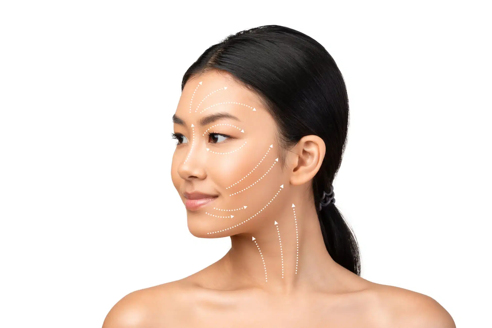 korean dermal fillers injection sites outlined on a woman's face