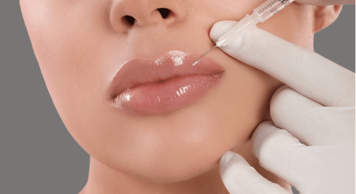 Achieving Natural-Looking Lips with Filorga Lip Filler