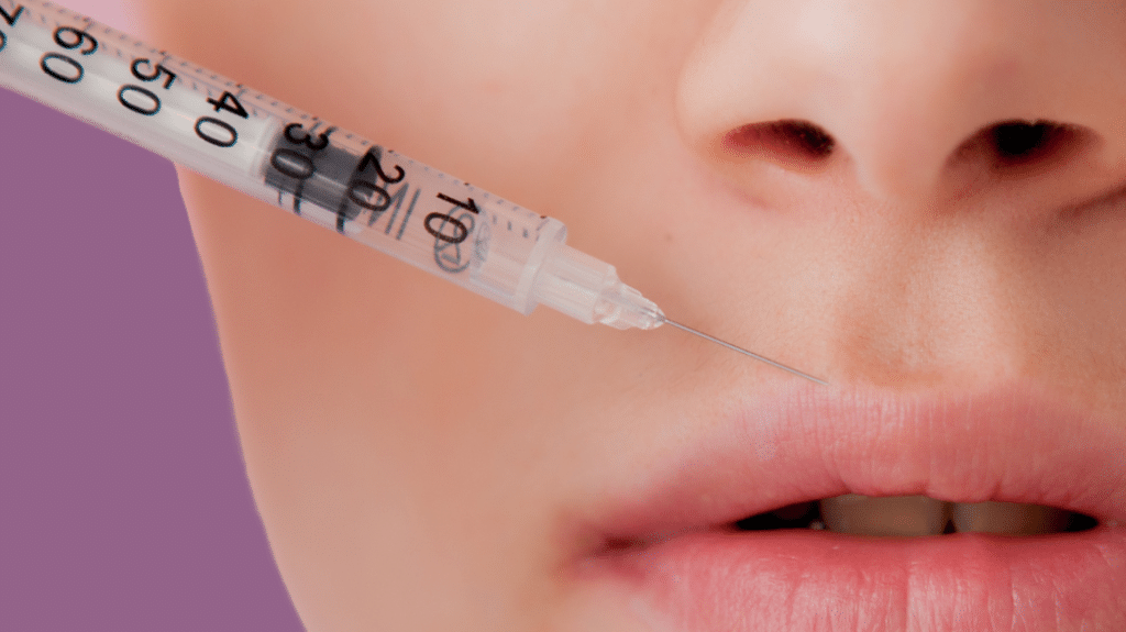 Filorga lip filler treatment process