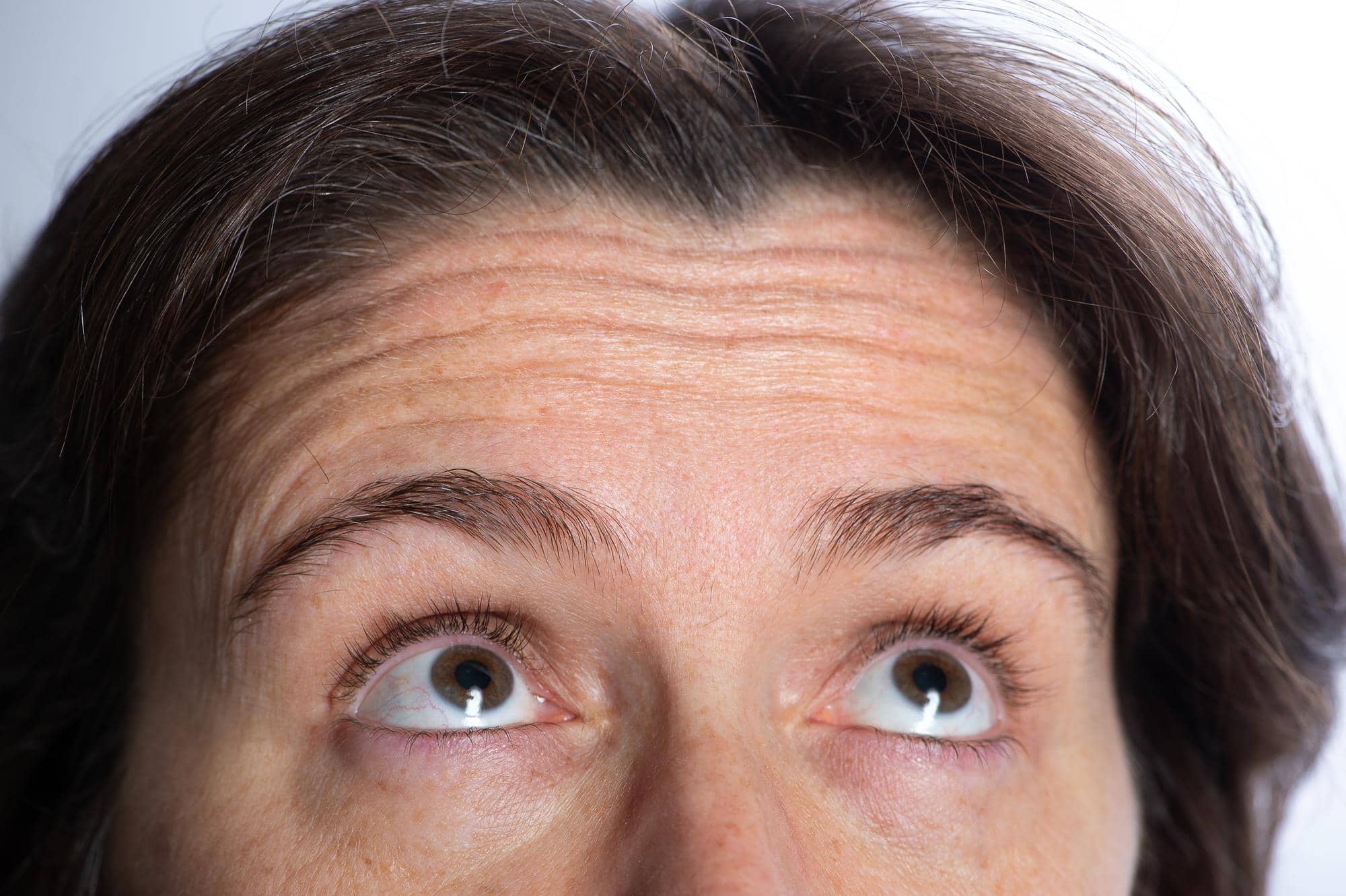 Deep wrinkles appear across the forehead of a person.