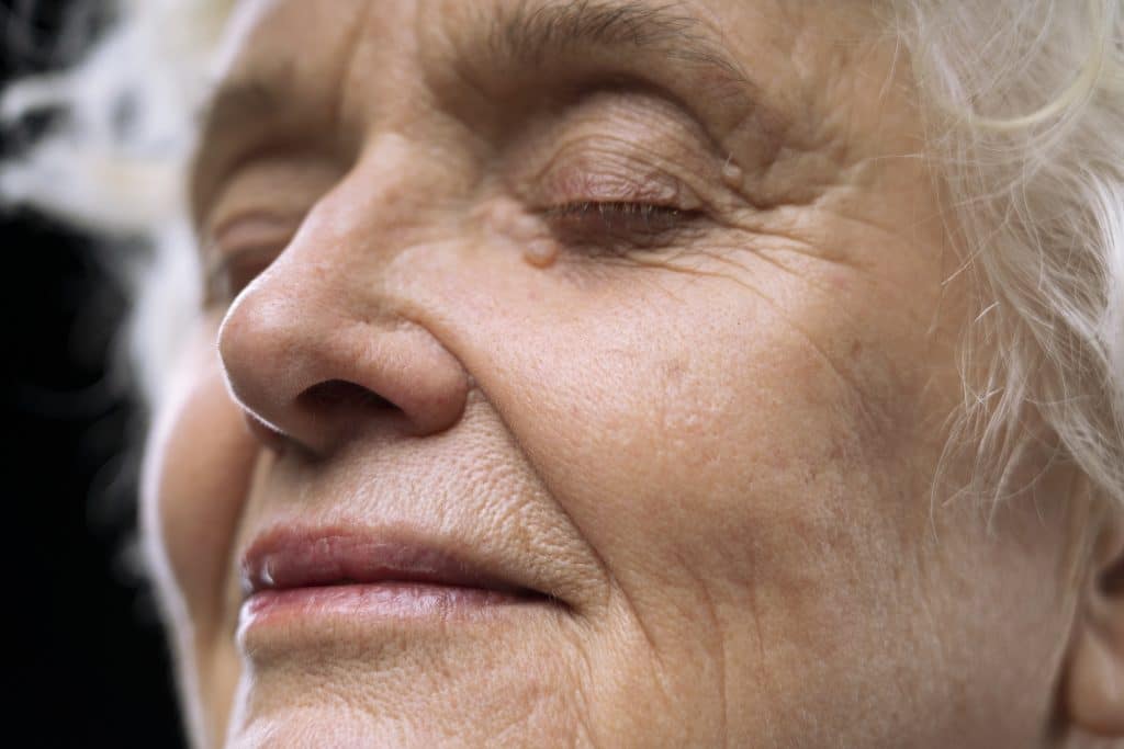 Wrinkles as a sign of aging