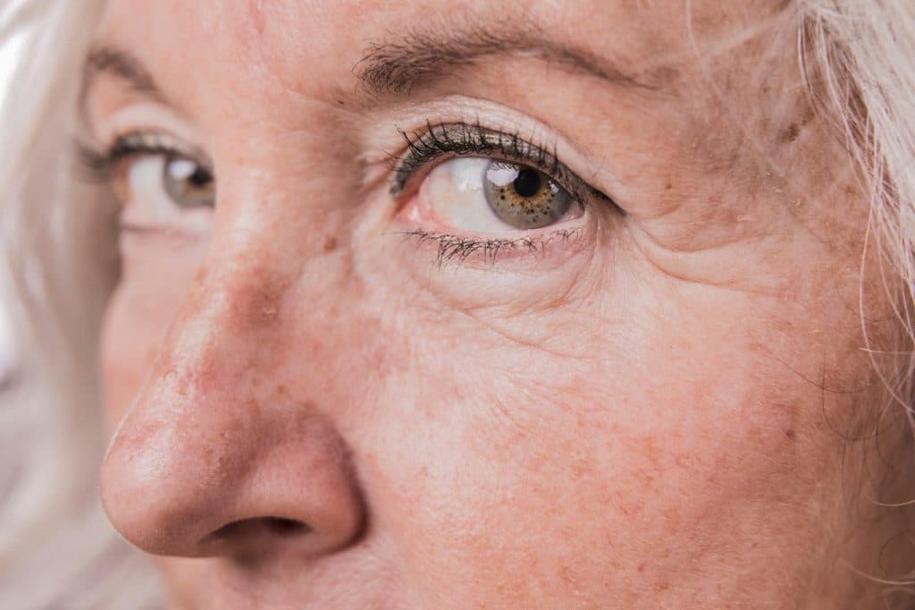 Close-up view of facial wrinkles around the eyes.