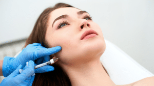 Radiesse Before and After Jowls Treatment - Medical SPA RX