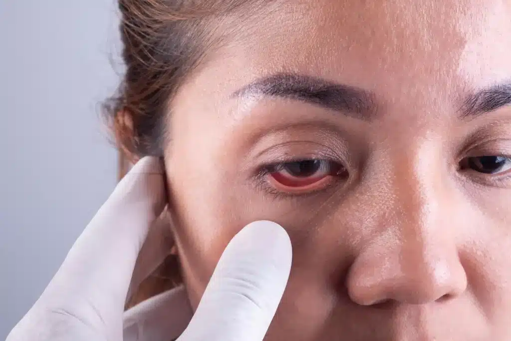 doctor needs to see her eyeballs for checking