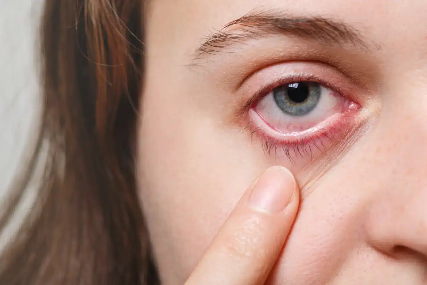 eyeball check