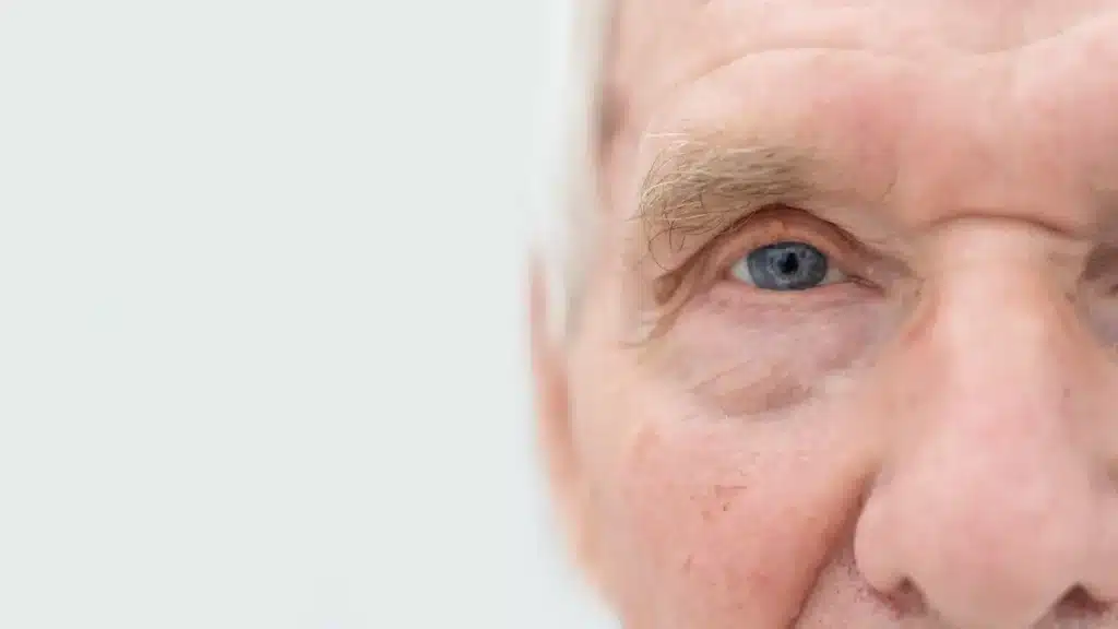 eyes of elderly