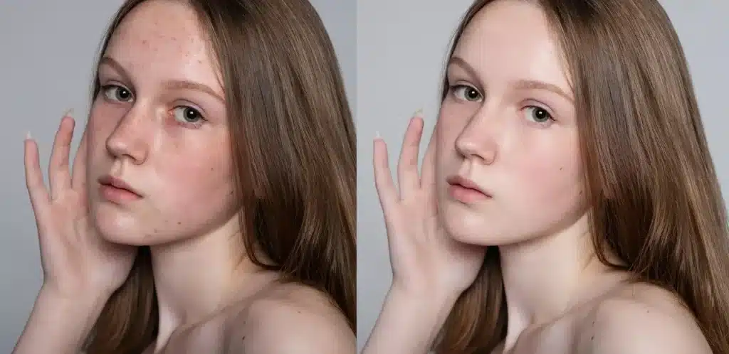 her beautiful face before and after
