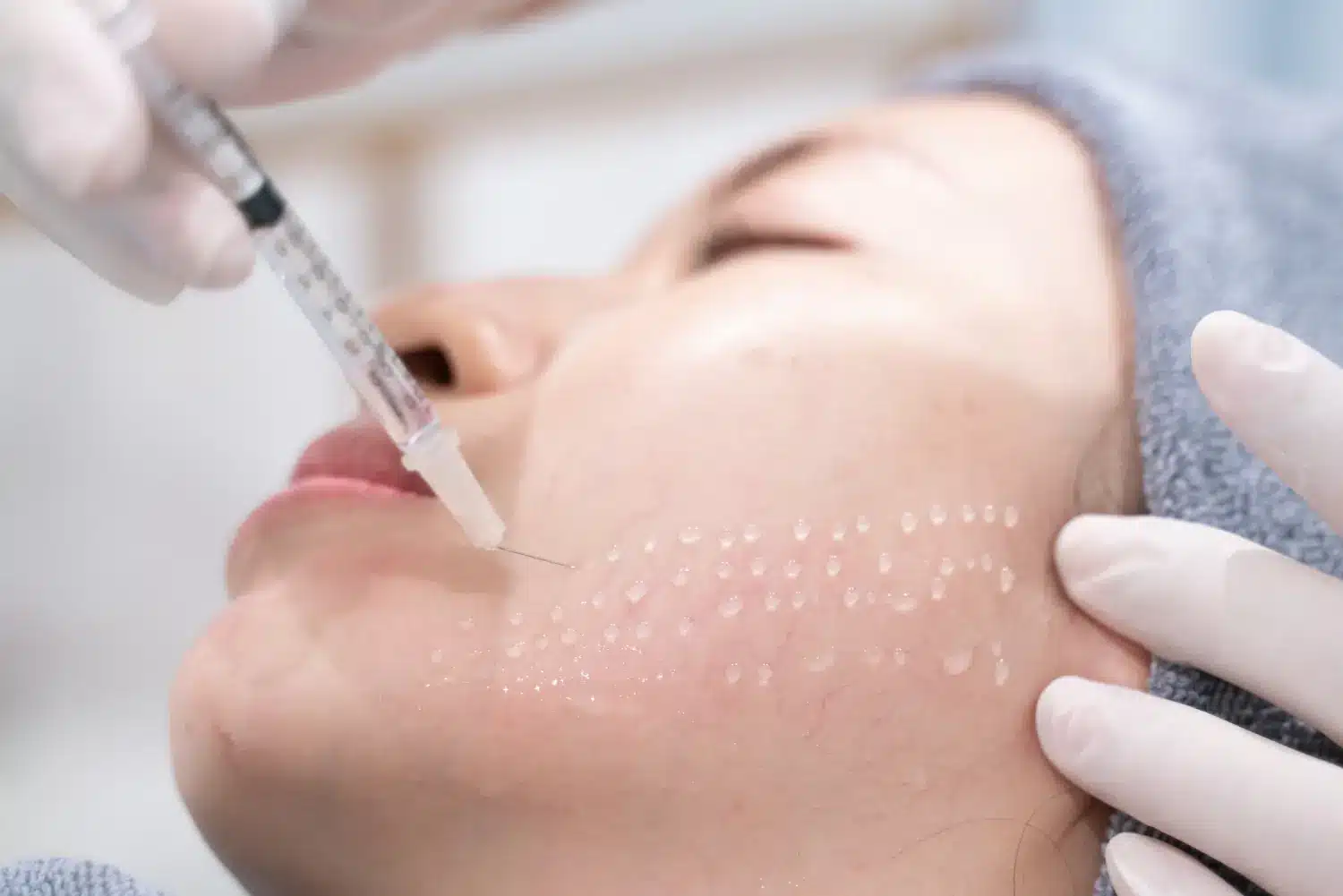 injecting minerals