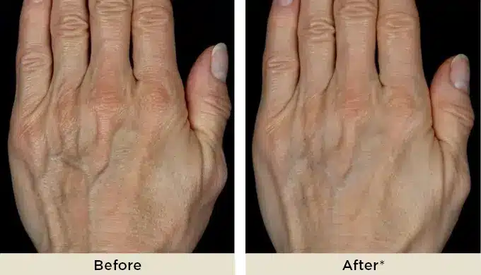 less hand wrinkles