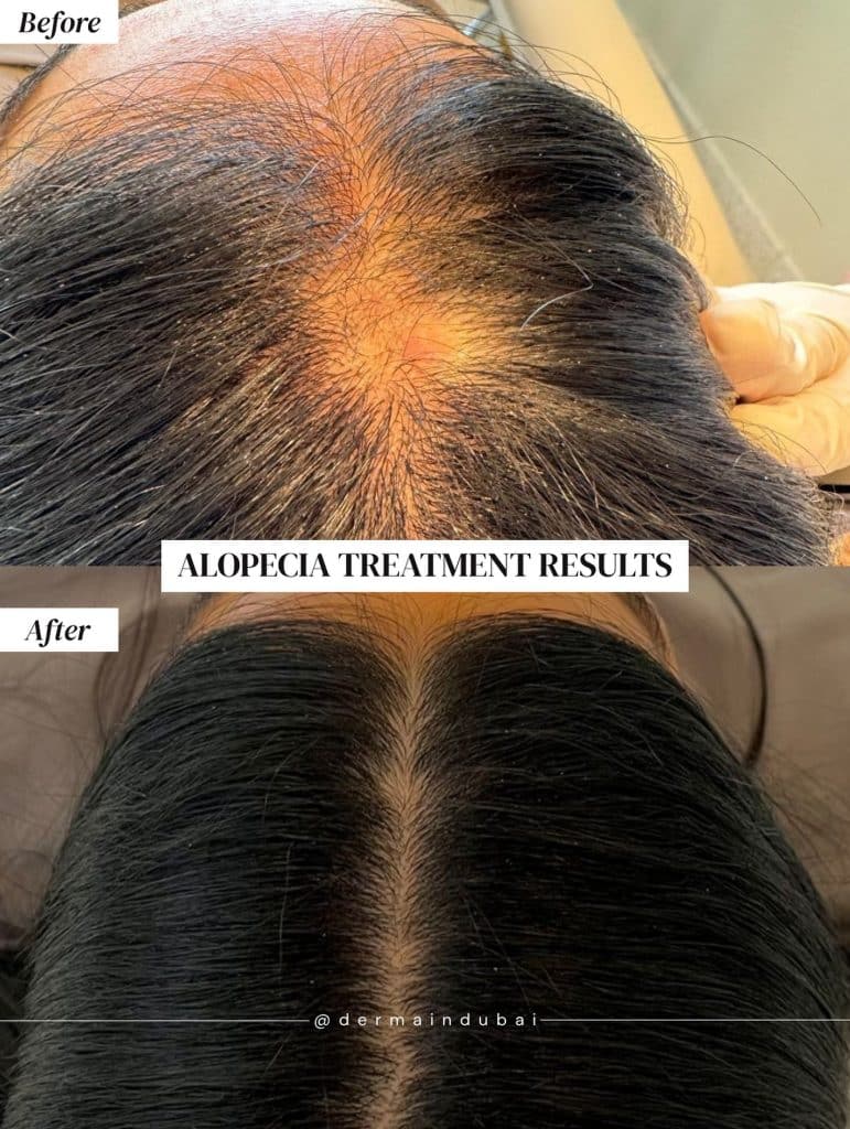 her scalp becomes healthier