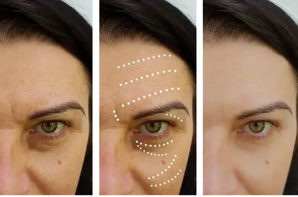 her treatment made all these changes in her skin