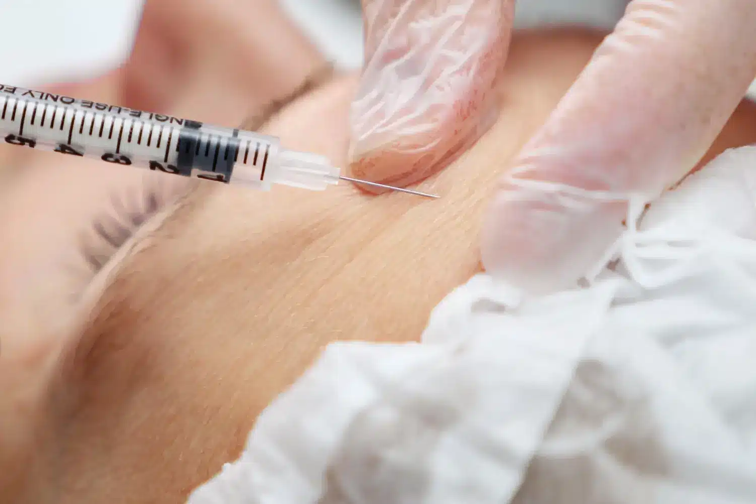 injection on the forehead