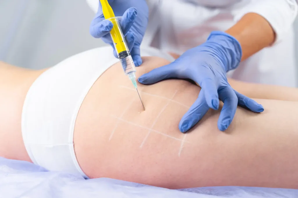hip injection that will eliminate the fats