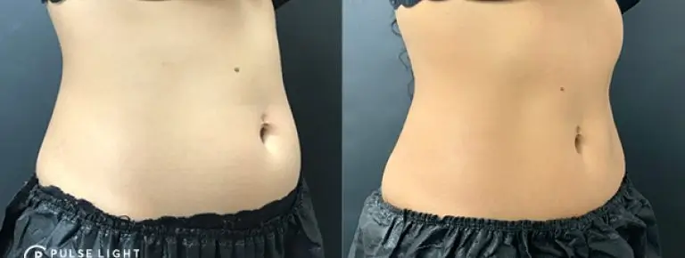 sexy tummy
