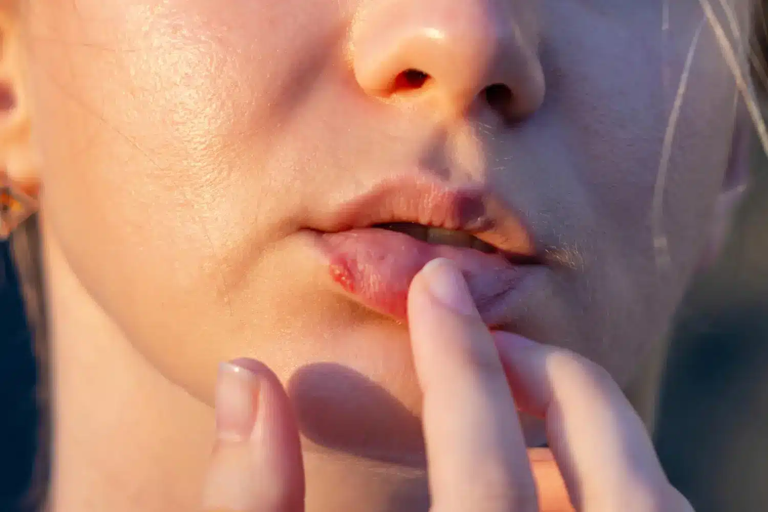 wound in the lips