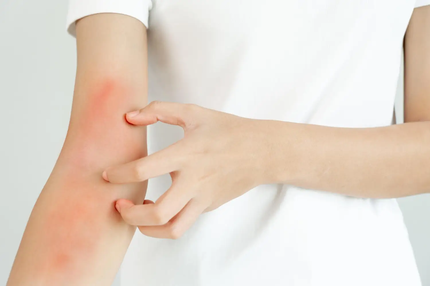 she's scratching her skin because of the burn