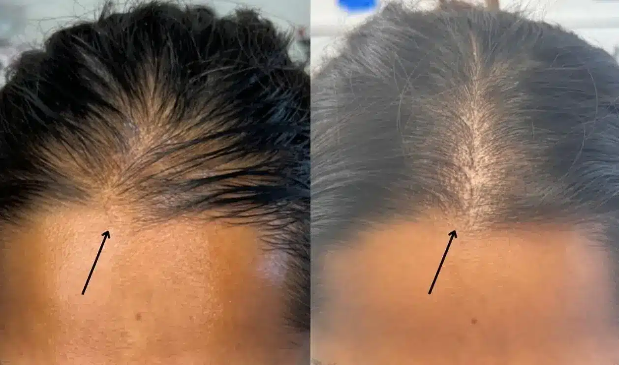 more hair
