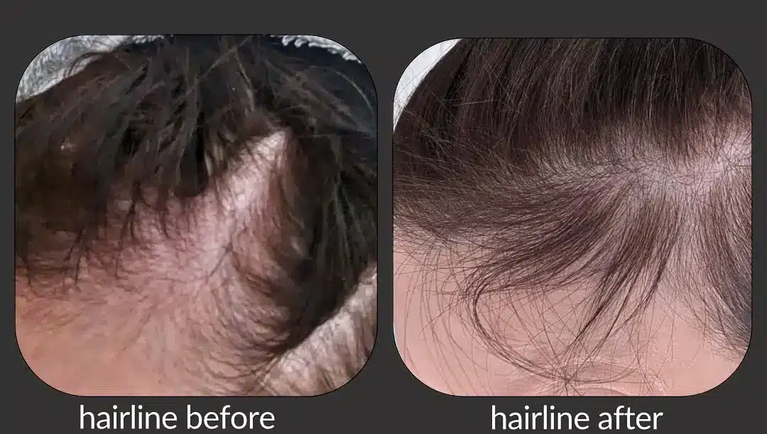 healthy scalp