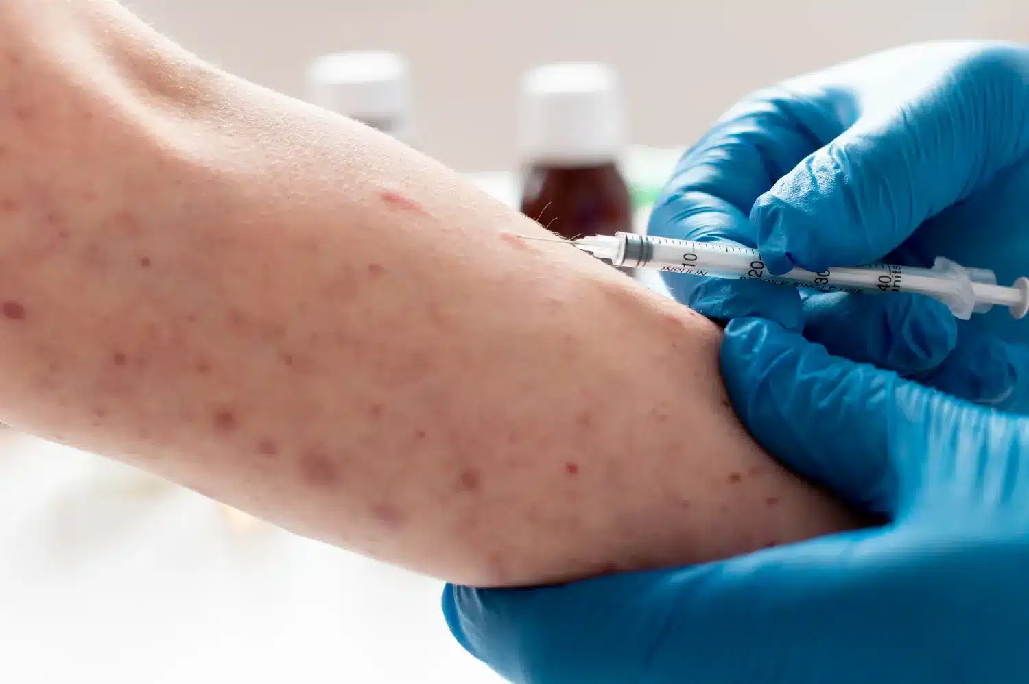 injection for the arm