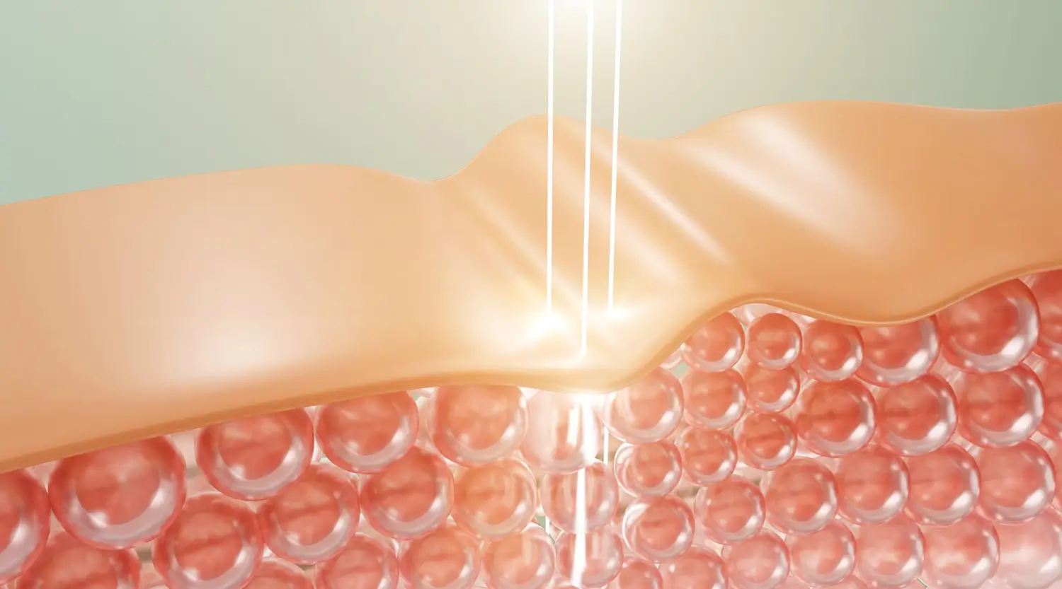 Digital representation of skin cells receiving light treatment, targeting collagen for anti-aging and smoother skin.