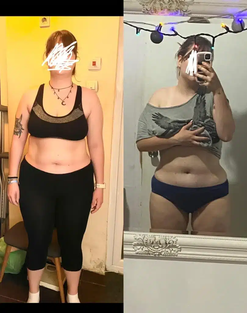 Patient shares her weight loss result after the treatment.