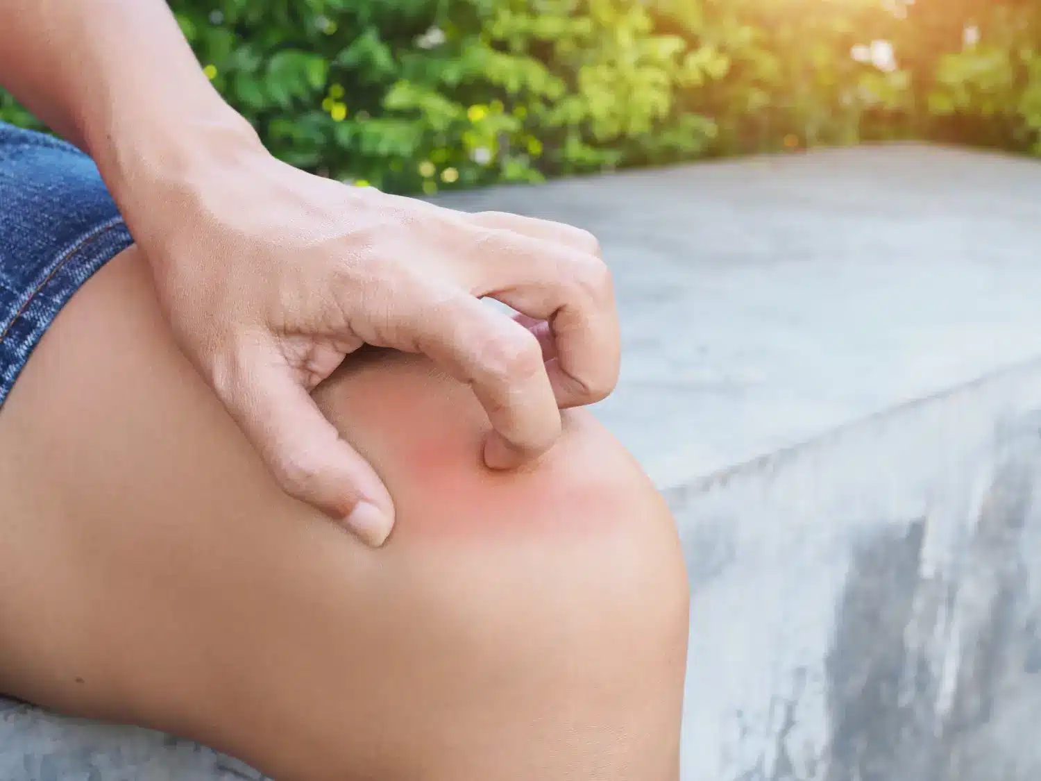 Person scratching the itchy part in his knee and leg.