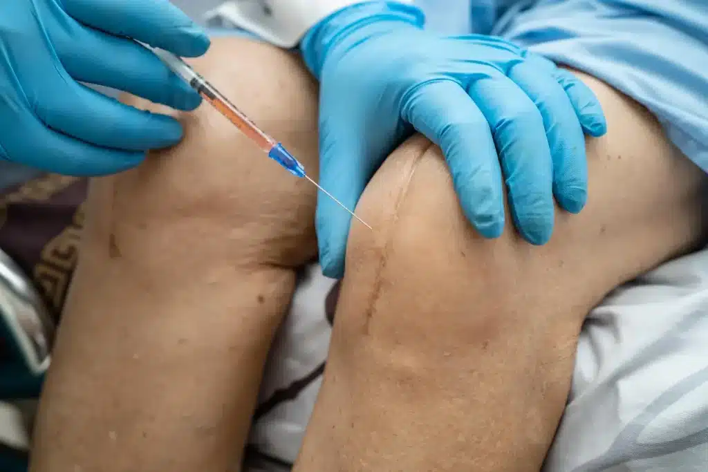 Administering knee injection for pain relief, maybe Orthovisc or other viscosupplement.