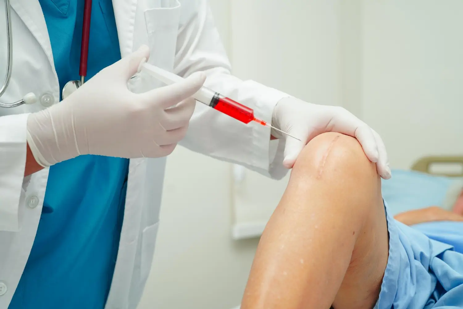 Doctor administers on the knee a treatment, could be Orthovisc or Synvisc, for pain relief and joint recovery.